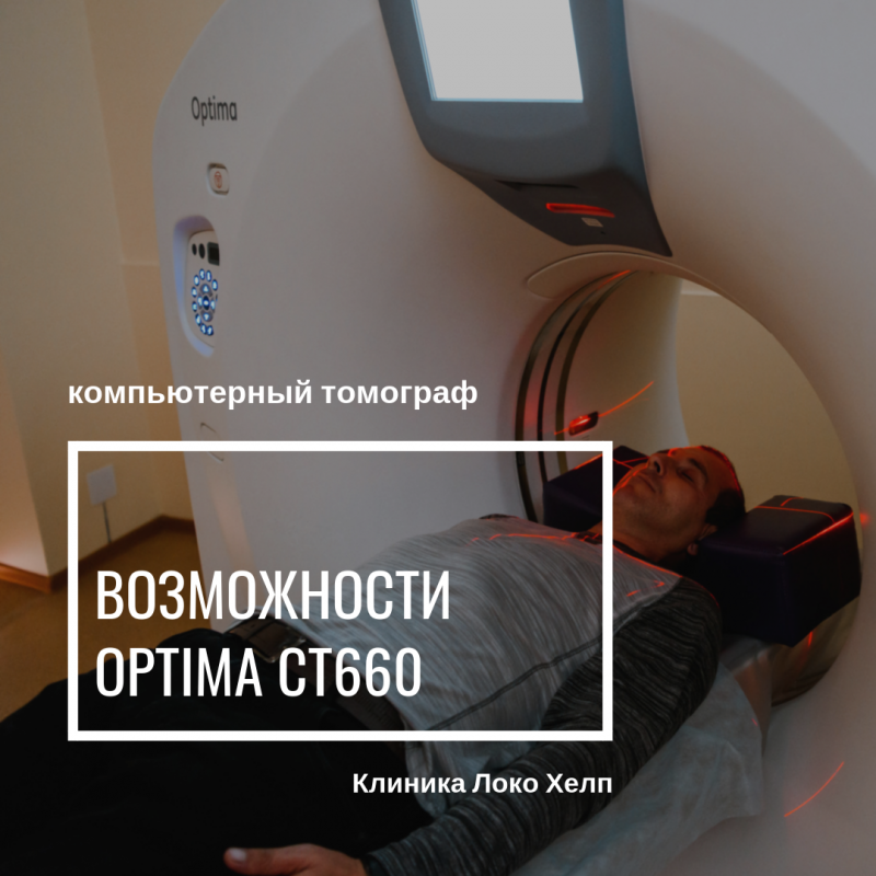 Компьютерная томография на современном томографе